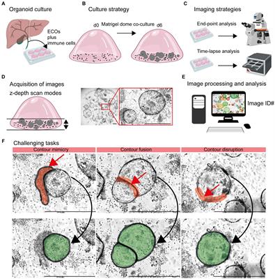 Analysis of organoid and immune cell co-cultures by machine learning-empowered image cytometry